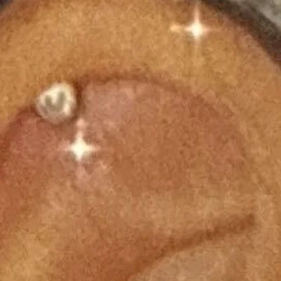 Helix-Ohrpiercing am oberen Ohrknorpel